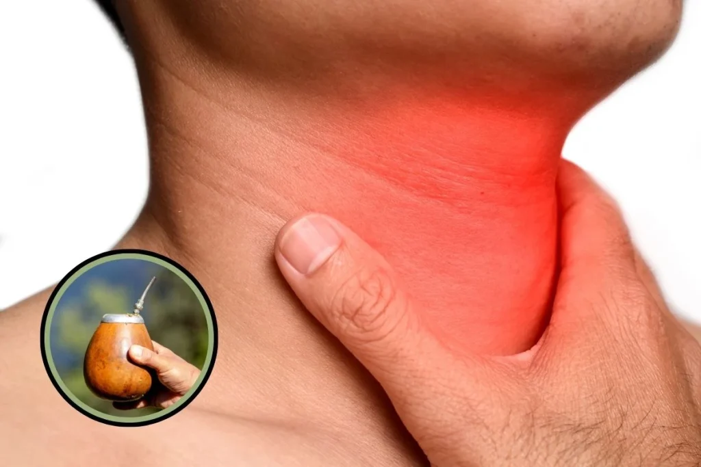 el mate produce cancer